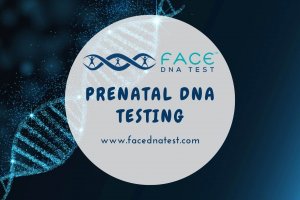 Prenatal DNA Testing