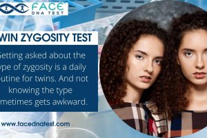 Twin Zygosity testing