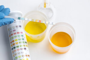 When should the temperature of a urine specimen for drug testing should be taken?